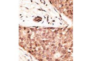 Image no. 2 for anti-Caudal Type Homeobox 2 (CDX2) (N-Term) antibody (ABIN358610) (CDX2 Antikörper  (N-Term))