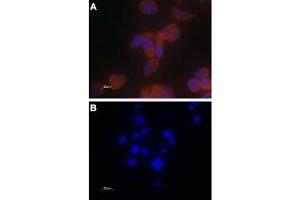 Expression of TRPV6 in PC-3 cells - Immunocytochemical staining of paraformaldehyde-fixed PC-3 cells with Anti-TRPV6 Antibody (ABIN7043857, ABIN7043998 and ABIN7043999), (1:100) followed by goat anti-rabbit-AlexaFluor-555 secondary antibody (A) or with a mixture of Anti-TRPV6 Antibody and TRPV6 peptide antigen (1:20) (B). (TRPV6 Antikörper  (C-Term, Intracellular))
