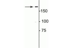 Western blot of rat lung lysate showing specific immunolabeling of the ~180 kDa collagen 1. (COL1A1 Antikörper)