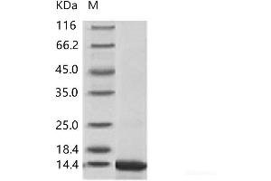 Zika Virus Envelope (ZIKV E) (AA 593-699) protein (His tag)