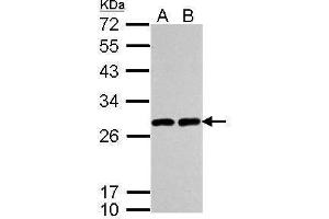 WB Image Sample (30 ug of whole cell lysate) A: A549 B: H1299 12% SDS PAGE antibody diluted at 1:5000 (UCHL1 Antikörper  (C-Term))