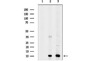 Western blot analysis of lysates from various samples, using SEC61B Antibody.