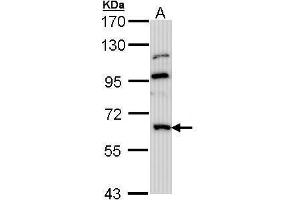 WB Image Sample (30 ug of whole cell lysate) A: Hep G2 7. (MGAT3 Antikörper)