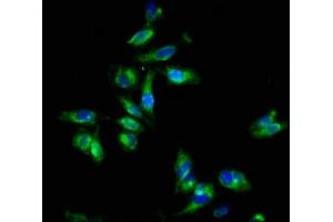 Immunofluorescence staining of Hela cells with ABIN7152021 at 1:133, counter-stained with DAPI. (EPOR Antikörper  (AA 320-506))