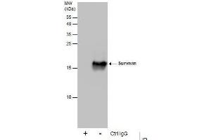 IP Image Immunoprecipitation of Survivin protein from 293T whole cell extracts using 5 μg of Survivin antibody, Western blot analysis was performed using Survivin antibody, EasyBlot anti-Rabbit IgG  was used as a secondary reagent. (Survivin Antikörper)