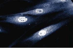 Immunofluorescent staining of human fibroblast cells. (STAT1 Antikörper  (AA 1-194))