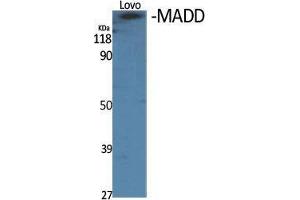 Western Blot (WB) analysis of specific cells using MADD Polyclonal Antibody.