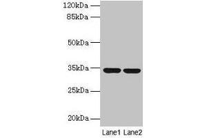 Western blot All lanes: MRPL19 antibody at 2 μg/mL Lane 1: MCF-7 whole cell lysate Lane 2: Mouse liver tissue Secondary Goat polyclonal to rabbit IgG at 1/10000 dilution Predicted band size: 34 kDa Observed band size: 34 kDa (MRPL19 Antikörper  (AA 1-292))