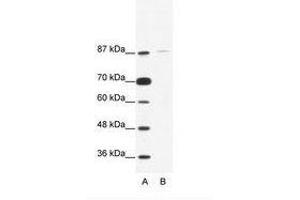 Image no. 1 for anti-TATA Box Binding Protein (TBP)-Associated Factor, RNA Polymerase I, C, 110kDa (TAF1C) (C-Term) antibody (ABIN203252) (TAF1C Antikörper  (C-Term))