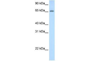 ADAT1 antibody used at 0. (ADAT1 Antikörper  (C-Term))