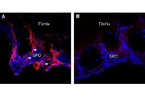 Expression of Aquaporin 4 in rat subfornical organ (SFO). (Aquaporin 4 Antikörper  (Intracellular))