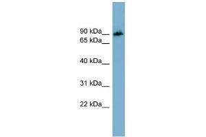 Western Blotting (WB) image for anti-Amyloid beta (A4) Precursor Protein-Binding, Family B, Member 1 Interacting Protein (APBB1IP) (N-Term) antibody (ABIN2787170)
