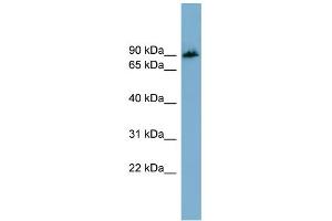 WB Suggested Anti-APBB1IP Antibody Titration: 0. (Amyloid beta (A4) Precursor Protein-Binding, Family B, Member 1 Interacting Protein (APBB1IP) (N-Term) Antikörper)