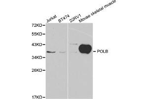 Western blot analysis of extracts of various cell lines, using POLB antibody (ABIN5970839) at 1/1000 dilution. (POLB Antikörper)