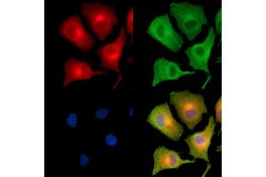 ABIN6260967 and ABIN6279315 staining  cells by IF/ICC.