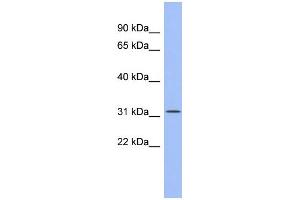 WB Suggested Anti-SPIB Antibody Titration:  0. (SPIB Antikörper  (Middle Region))