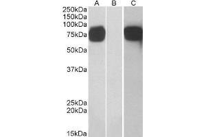 Western Blotting (WB) image for Golgi Membrane Protein 1 (GOLM1) peptide (ABIN369482) (Golgi Membrane Protein 1 (GOLM1) Peptid)