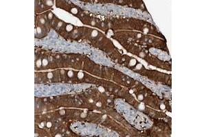 Immunohistochemical staining of human duodenum with ANKRD34A polyclonal antibody  shows strong cytoplasmic and membrane positivity in glandular cells. (ANKRD34A Antikörper)