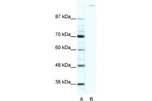 WB Suggested Anti-GLI1 Antibody Titration:  2. (GLI1 Antikörper  (C-Term))