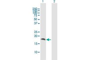 Western Blot analysis of CRYGD expression in transfected 293T cell line by CRYGD MaxPab polyclonal antibody. (CRYGD Antikörper  (AA 1-174))