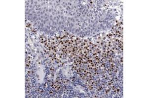 Immunohistochemical staining of human IRF4 polyclonal antibody  shows strong nuclear positivity in lymphoid cells outside reaction centra at 1:250 dilution. (IRF4 Antikörper)