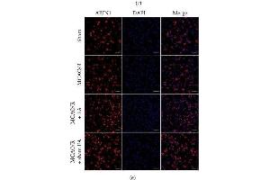 ABIN1 expression in the peri-infarct area at different time points. (TNIP1 Antikörper)