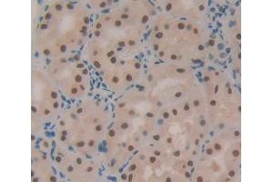 Immunohistochemistry (IHC) image for anti-X-Ray Repair Complementing Defective Repair in Chinese Hamster Cells 5 (Double-Strand-Break Rejoining) (XRCC5) (AA 2-460) antibody (ABIN1872441)