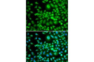 Immunohistochemistry of paraffin-embedded human stomach using SETD5 antibody at dilution of 1:100 (x400 lens). (SETD5 Antikörper)