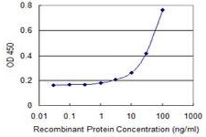 Detection limit for recombinant GST tagged MRS2 is 1 ng/ml as a capture antibody. (MRS2 Antikörper  (AA 1-117))