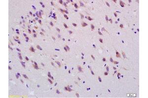 Formalin-fixed and paraffin embedded rat brain labeled with Anti-Smoothened/SMO Polyclonal Antibody, Unconjugated  at 1:200, followed by conjugation to the secondary antibody and DAB staining (SMO Antikörper  (AA 551-650))