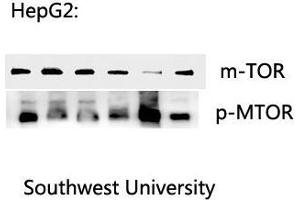 Western Blot (WB) analysis: Please contact us for more details. (MTOR Antikörper  (pSer2448))