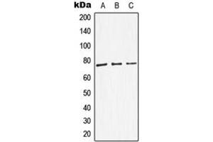 Western blot analysis of Dopamine beta Hydroxylase expression in HEK293T (A), SP2/0 (B), NIH3T3 (C) whole cell lysates. (DBH Antikörper  (Center))