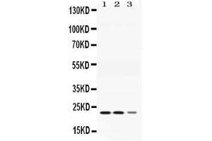 Western blot analysis of Adenylate Kinase 1 expression in rat skeletal muscle extract ( Lane 1), mouse cardiac muscle  extract ( Lane 2) and COLO320 whole cell lysates ( Lane 3).