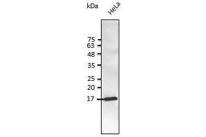 Anti-SNCG Ab at 1/2,500 dilution, lysate at 50 µg per Iane, rabbit polyclonal to goat lgG (HRP) at 1/10,000 dilution, (SNCG Antikörper  (C-Term))
