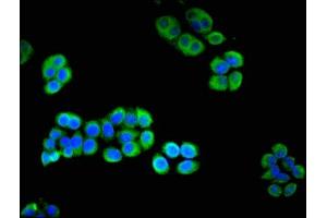 Immunofluorescent analysis of PC-3 cells using ABIN7166973 at dilution of 1:100 and Alexa Fluor 488-congugated AffiniPure Goat Anti-Rabbit IgG(H+L) (CHM Antikörper  (AA 1-653))