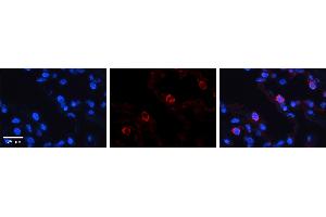 VARS antibody - middle region          Formalin Fixed Paraffin Embedded Tissue:  Human Lung Tissue    Observed Staining:  Cytoplasm of pneumocytes   Primary Antibody Concentration:  1:100    Other Working Concentrations:  1/600    Secondary Antibody:  Donkey anti-Rabbit-Cy3    Secondary Antibody Concentration:  1:200    Magnification:  20X    Exposure Time:  0. (VARS Antikörper  (Middle Region))