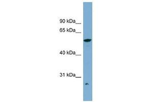ALDH3A2 antibody used at 1 ug/ml to detect target protein. (ALDH3A2 Antikörper  (Middle Region))
