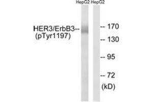 Western blot analysis of extracts from HepG2 cells , using HER3 (Phospho-Tyr1197) Antibody. (ERBB3 Antikörper  (pTyr1197))