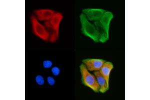 ABIN6258974 and ABIN6275995 staining Hela cells(30 min of UV treatment) by IF/ICC. (GPR137C Antikörper  (Internal Region))