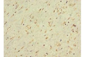 Immunohistochemistry of paraffin-embedded human smooth muscle tissue using ABIN7158484 at dilution of 1:100 (LONRF1 Antikörper  (AA 538-773))
