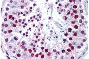 Testis (MECP2 Antikörper  (AA 11-25))