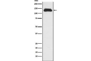 Western blot analysis of Eg5 expression in Raji cell lysate.