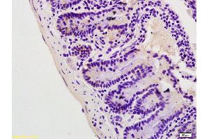 Formalin-fixed and paraffin embedded mouse colon labeled with Anti Lpin1 Polyclonal Antibody, Unconjugated (ABIN672831) at 1:200 followed by conjugation to the secondary antibody and DAB staining. (Lipin 1 Antikörper  (AA 201-300))