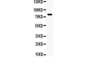 Anti- FE65 antibody, Western blotting All lanes: Anti  at 0.