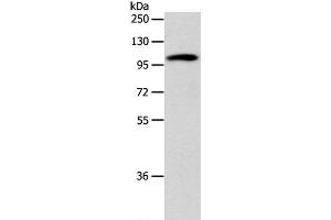 Western Blot analysis of 293T cell using ADCY1 Polyclonal Antibody at dilution of 1:1000 (ADCY1 Antikörper)