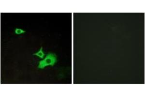 Immunofluorescence analysis of LOVO cells, using ETBR2 Antibody. (ETBR2 Antikörper  (AA 1-50))