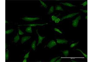 Immunofluorescence of purified MaxPab antibody to PSME3 on HeLa cell. (PSME3 Antikörper  (AA 1-254))