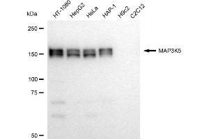 Western blotting analysis using MAP3K5 antibody (ABIN7799472).