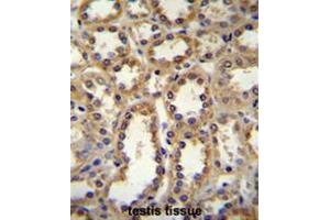 GPC6 Antibody (C-term) immunohistochemistry analysis in formalin fixed and paraffin embedded human kidney tissue followed by peroxidase conjugation of the secondary antibody and DAB staining. (Glypican 6 Antikörper  (C-Term))