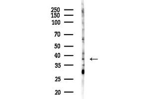 anti-Epidermal Retinal Dehydrogenase 2 (RDHE2) antibody